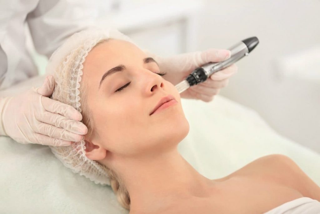 Microneedling | Everything There Is To Know About Microneedling | Her Beauty