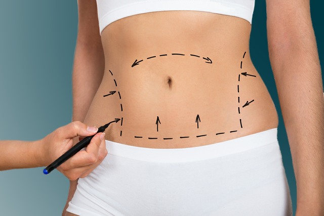 Board-certified plastic surgeon | Everything To Know About The Non Surgical Tummy Tuck | Her Beauty